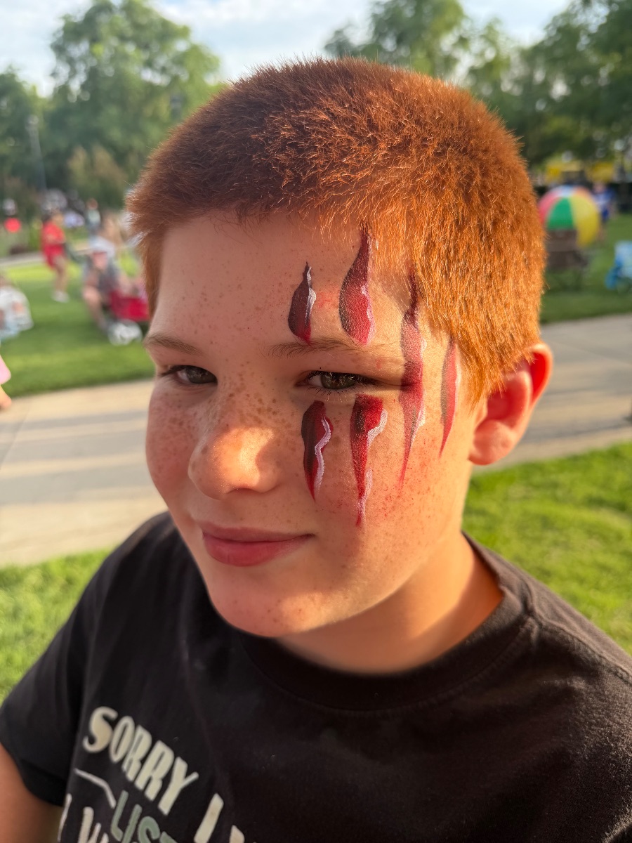 Claw marks